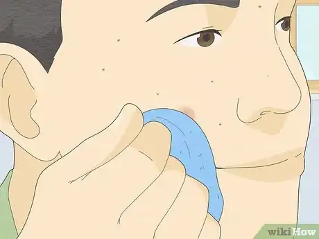 Imagen titulada Pop a Pimple Step 19