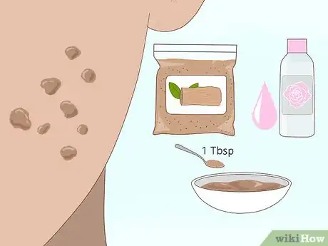 Imagen titulada Get Rid of Acne Scars Fast Step 16