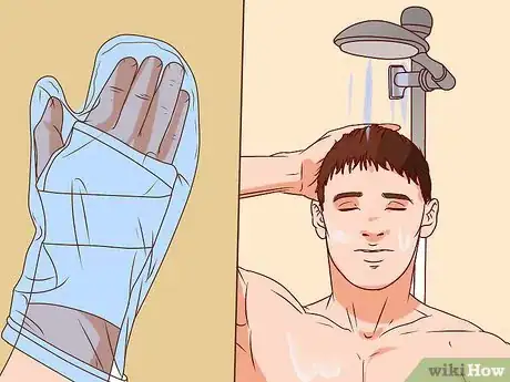 Imagen titulada Apply a Cast to a Broken Arm Step 12