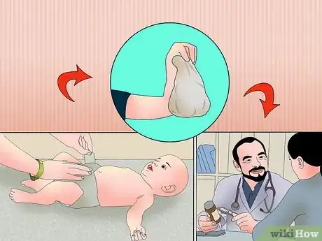 Imagen titulada Treat Diarrhea in Newborns Step 3