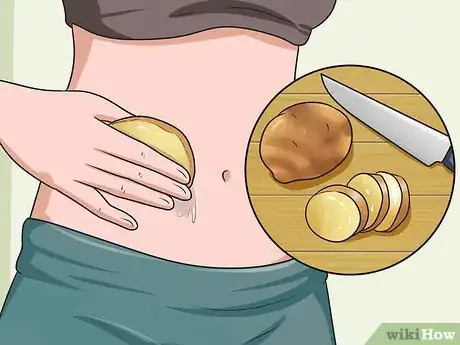Imagen titulada Get Rid of Stretch Marks Fast Step 5