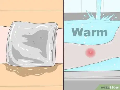 Imagen titulada Remove Pus from a Wound Step 3