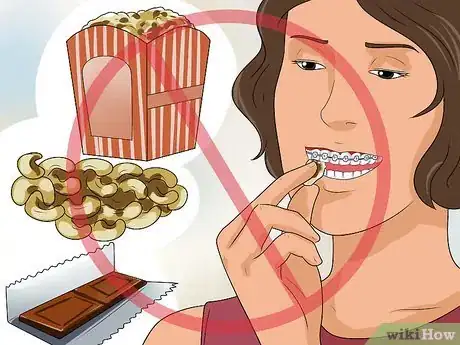 Imagen titulada Get Your Braces off Faster Step 8