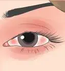 hacer que tu ojo o ceja dejen de saltar