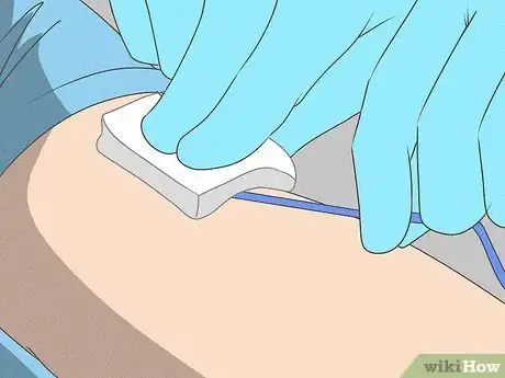 Imagen titulada Remove a PICC Line Step 7