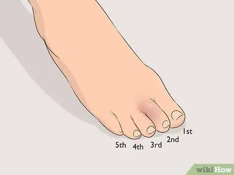 Imagen titulada Buddy Tape an Injured Toe Step 1