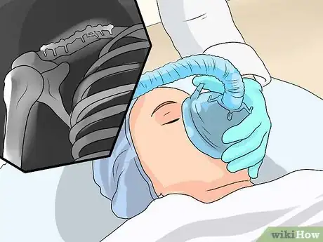 Imagen titulada Relieve Pain from Clavicle Fracture Step 3