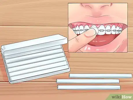 Imagen titulada Alleviate Orthodontic Brace Pain Step 10