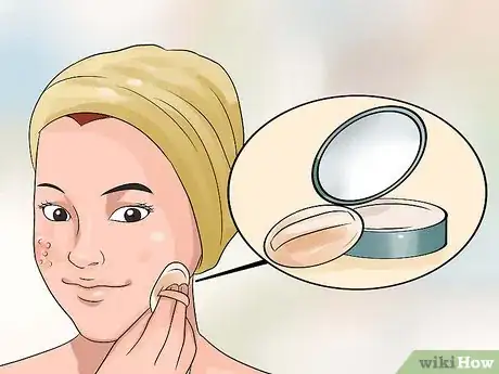 Imagen titulada Hide Pimples Step 11