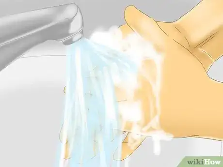 Imagen titulada Treat a Staph Infection Step 9