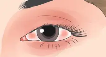 hacer que tu ojo o ceja dejen de saltar