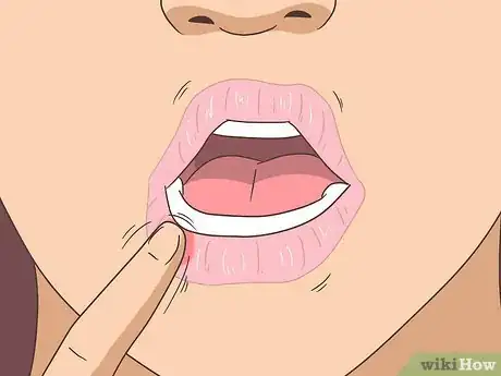 Imagen titulada Get Rid of Numbness in Your Lip Step 4