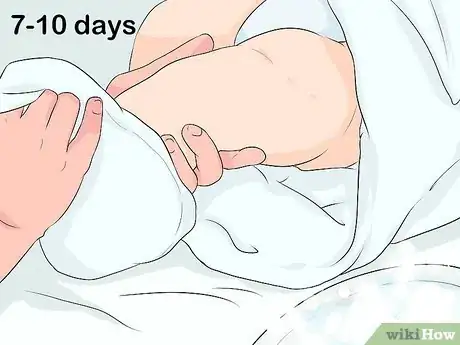 Imagen titulada Clean a Circumcision Step 4