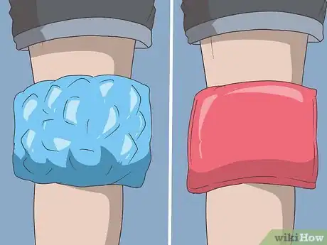 Imagen titulada Treat Crepitus Step 13