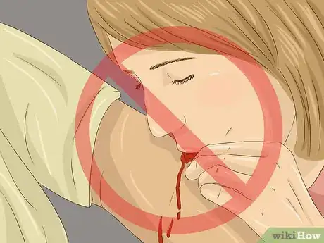 Imagen titulada Treat a Rattlesnake Bite Step 15
