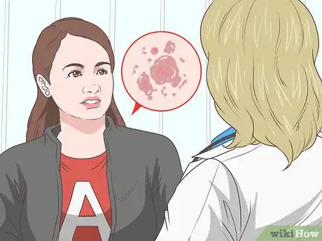 Imagen titulada Apply a Nicotine Patch Step 15