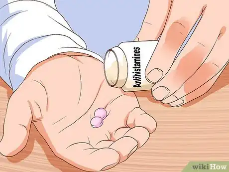 Imagen titulada Prevent Cat Allergies Step 2
