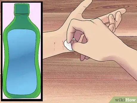 Imagen titulada Treat a Cat Bite Step 3