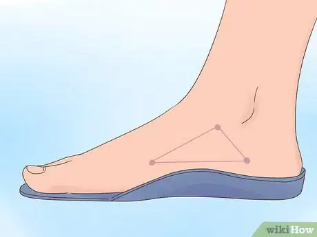 Imagen titulada Fix Pronated Feet Step 2