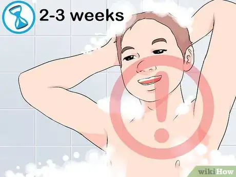 Imagen titulada Clean a Circumcision Step 9