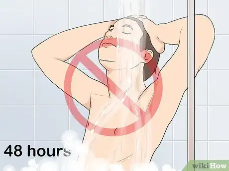 Imagen titulada Clean a Circumcision Step 6