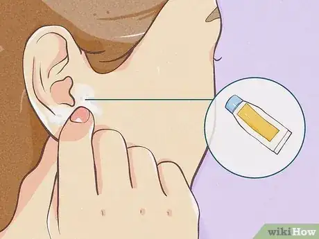 Imagen titulada Gauge Your Ears Step 12