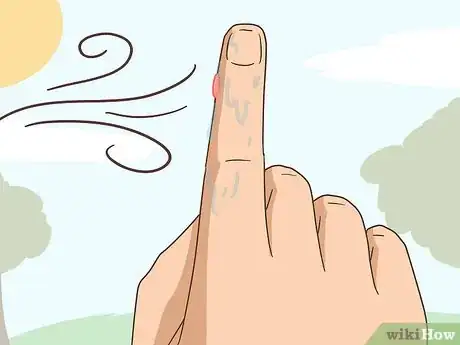 Imagen titulada Treat a Blistering Burn on Your Finger Step 6