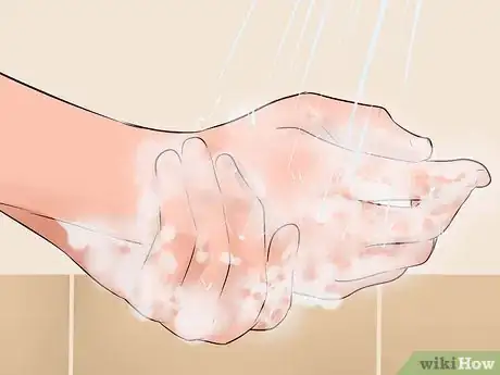 Imagen titulada Help a Male Child Provide a Urine Sample Step 27