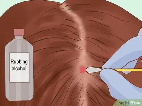 Imagen titulada Get Rid of Ticks in Your Hair Step 7