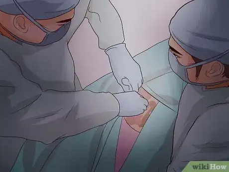 Imagen titulada Stop Bleeding Hemorrhoids Step 7