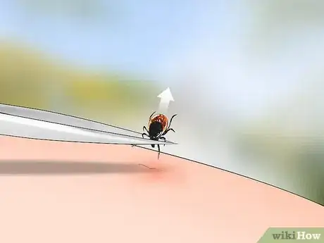 Imagen titulada Identify a Deer Tick Step 1