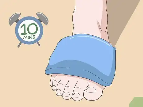 Imagen titulada Treat Extensor Tendonitis Step 1