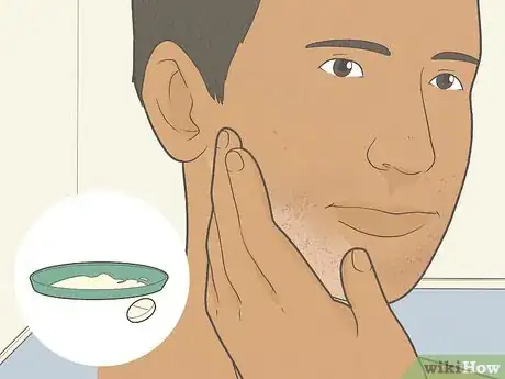 Imagen titulada Get Rid of Razor Burn Fast Step 15