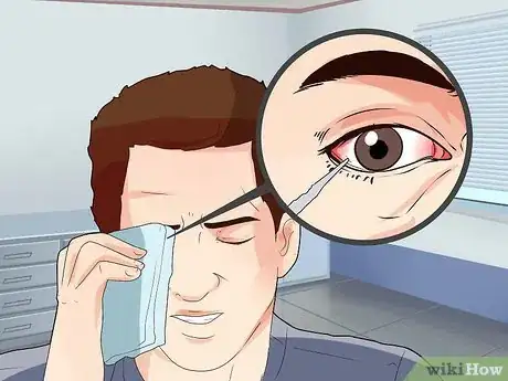 Imagen titulada Remove a Speck From Your Eye Step 10