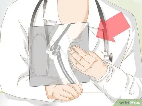Imagen titulada Treat Fractures in Cats Step 4