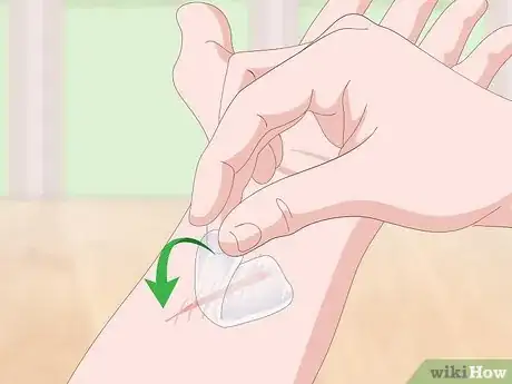 Imagen titulada Get Rid of Scars Step 4