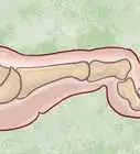 enderezar los dedos de los pies