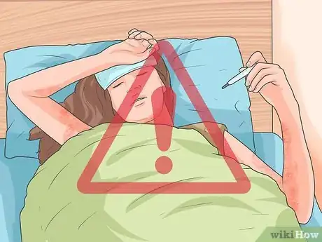 Imagen titulada Take a Throat Culture Step 3