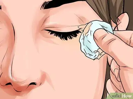 Imagen titulada Heal a Scratched Cornea Step 17