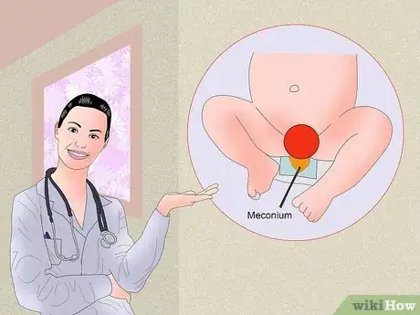 Imagen titulada Treat Diarrhea in Newborns Step 4