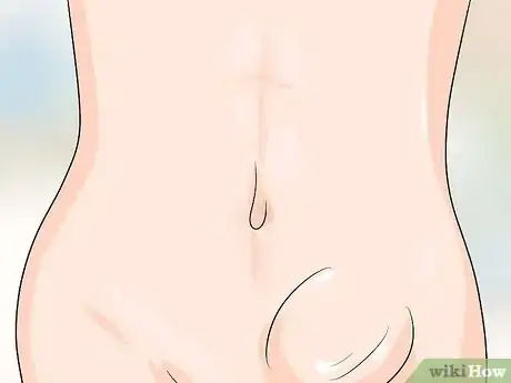 Imagen titulada Know if You Have a Hernia Step 20