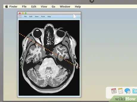 Imagen titulada Read an MRI Step 9