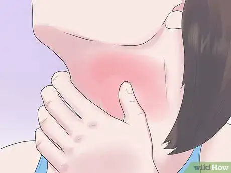 Imagen titulada Soothe an Itchy Throat Step 17