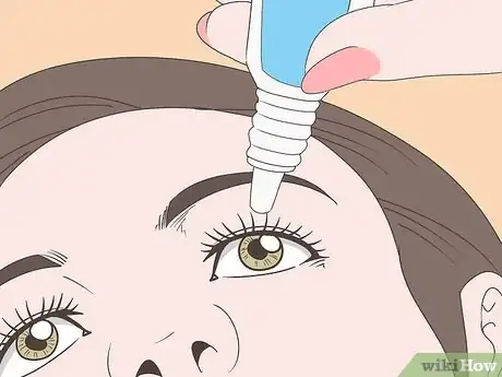 Imagen titulada Stop Watery Eyes Step 2