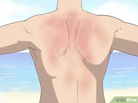 Imagen titulada Use Fresh Aloe Vera Step 5