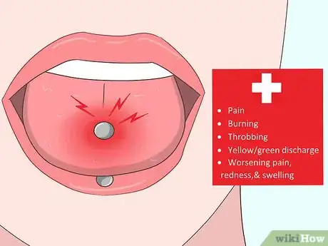 Imagen titulada Reduce Tongue Swelling Step 16