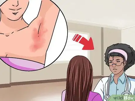 Imagen titulada Heal Chafed Skin Step 7
