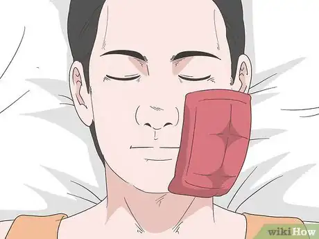 Imagen titulada Reduce Facial Swelling After Surgery Step 7