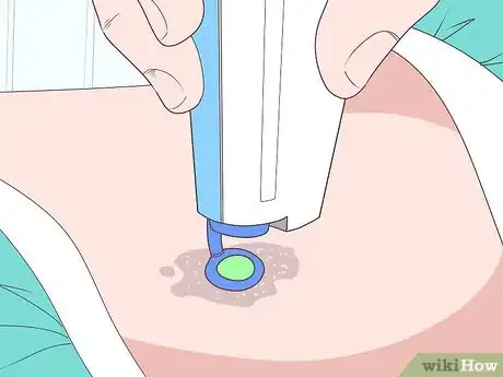 Imagen titulada Lighten Birthmarks Naturally Step 9