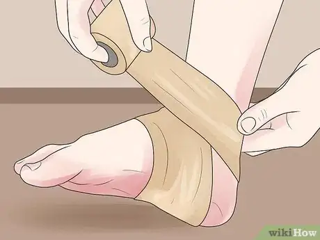 Imagen titulada Cure a Swollen Ankle Step 4